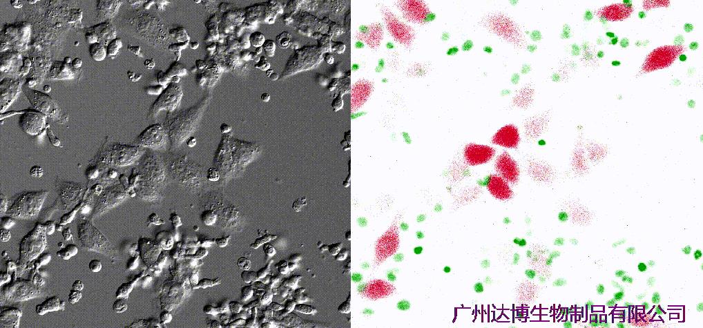 喜訊連連！達博生物“自體自然殺傷細胞注射液”獲II期臨床試驗默示許可